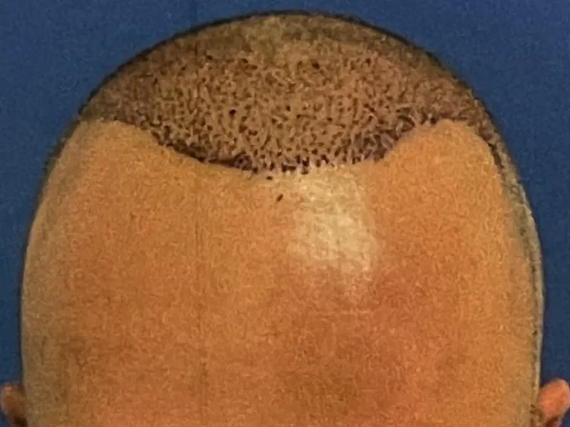 7a 7a